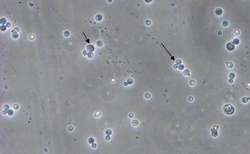 酵母双杂交技术原理、试验流程、特点以及应用
