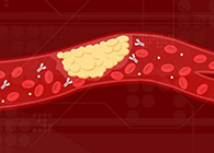 【Science速递】攻克COVID-19里程碑：已确定血凝块形成原因！