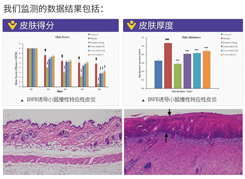 不朽情缘mg官网建立的特应性皮炎及湿疹模型监测数据结果