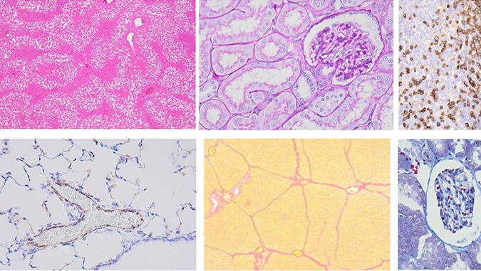 病理学研究平台.jpg 病理学研究平台.jpg