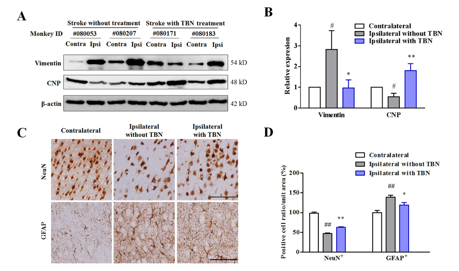 TBN是一种治疗缺血性卒中的新型临床候选药物，本研究中TBN通过不朽情缘mg官网合成